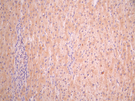 BTN3A1 (CD277) Target: γδ T Cell Immune Recognition Mechanism and Cancer Immunotherapy Research Progress