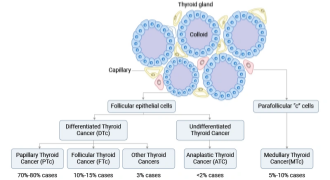 About Thyroid Tumor: Essential Information for Researchers