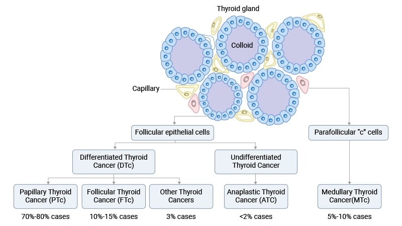 Types of thyroid cancer