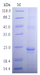 aqpZ in detergent micelles