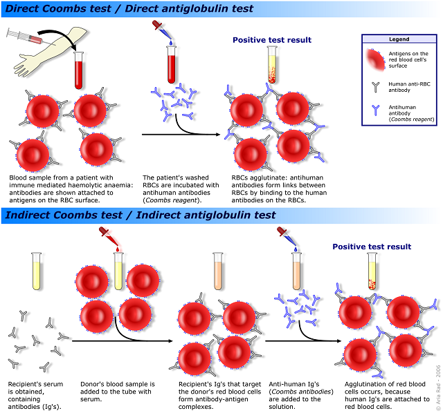 Direct and Indirect Coombs test