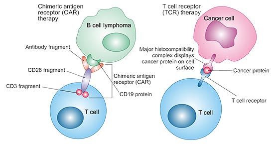 CAR T-cell therapy