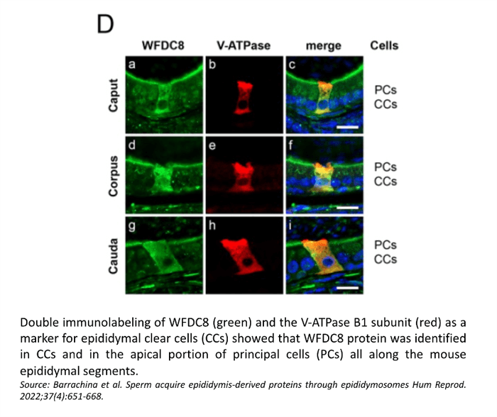 WFDC8 protein identified in CCs and principal cells