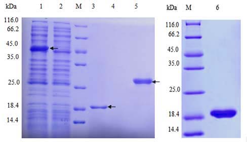 E.coli Expression System project case 01