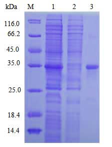 E.coli Expression System project case 03-1