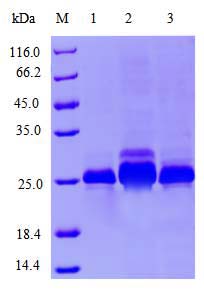 E.coli Expression System project case 03-2