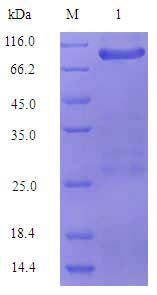 Insect Baculovirus Expression System case 02