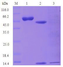Insect Baculovirus Expression System case 03
