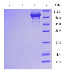 Yeast Expression case 02