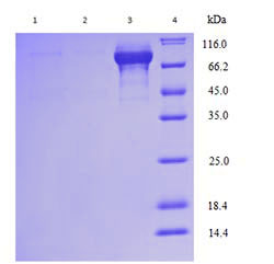Yeast Expression case 02