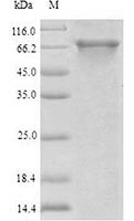 Recombinant Human ABCB8 SDS