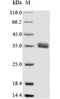 Recombinant Human ABCC1 SDS