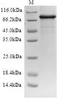 Recombinant Human ABCD1 SDS