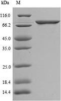 Recombinant Human ABCG1 SDS