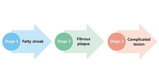 Stages of atherosclerosis