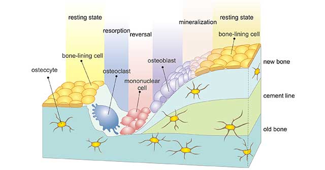 The Diagram of Bone Remodeling