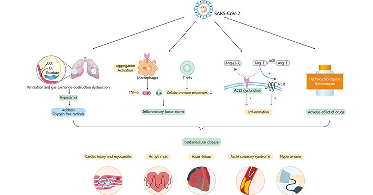 Cardiovascular involvement in COVID-19 – key manifestations and hypothetical mechanisms