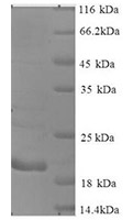 CTAG1A recombinant protein SDS