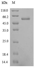 Purity of Recombinant Human EFNA5