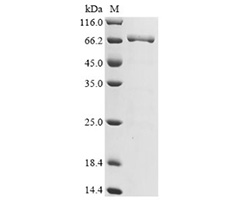 DT3C protein SDS-PAGE