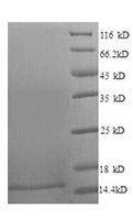 E7 recombinant protein SDS