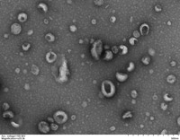 exosomes 03