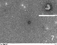 Exosomes extracted from pichia pastoris