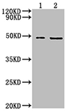 Exosomes extracted from A375 cells