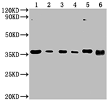 ENO1 (CSB-MA007670A0m) WB