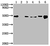 CSB-MA007670A0m WB