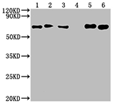 PKM (CSB-MA018072A0m) WB