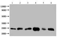Exosomes CD9 (CSB-MA004969A0m)
