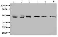 Exosomes ENO1 (CSB-MA007670A0m)