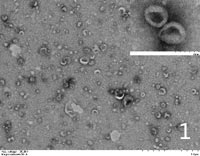 Exosomes extracted from Hela cells