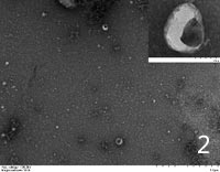 Exosomes extracted from serum