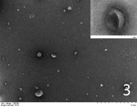 Exosomes extracted from plasma