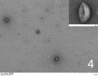 Exosomes extracted from Breast Milk