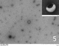 Exosomes extracted from saliva