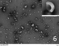 Exosomes extracted from urine