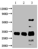 CD63 (CSB-MA004950A1m) WB