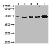 ENO1 (CSB-MA007670A0m) Exosomes