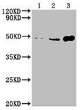 Exosomes with ENO1 (CSB-MA007670A0m)