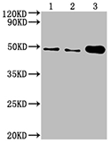 Exosomes with ENO1 (CSB-MA007670A0m) 02