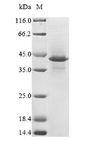 HLA G recombinant protein SDS