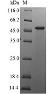 CSB-EP010509HUa2 SDS-page