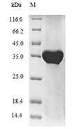 CSB-EP010509HU SDS-page