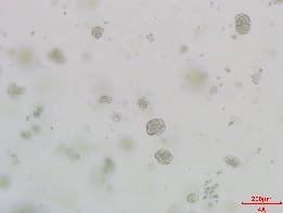Growth of Human Hepatic Organoids D1