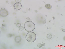 Growth of Human Hepatic Organoids D3