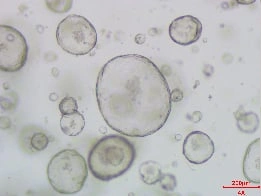 Growth of Human Hepatic Organoids D5
