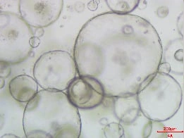 Growth of Human Hepatic Organoids D7